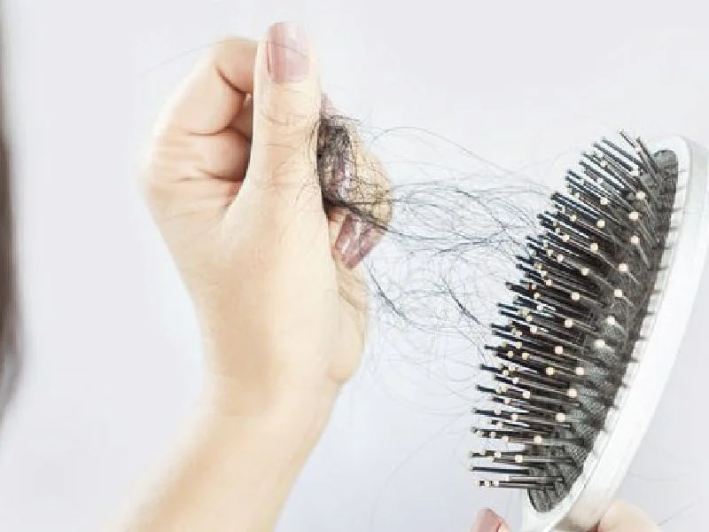 Tratamiento de caída de cabello en Puebla