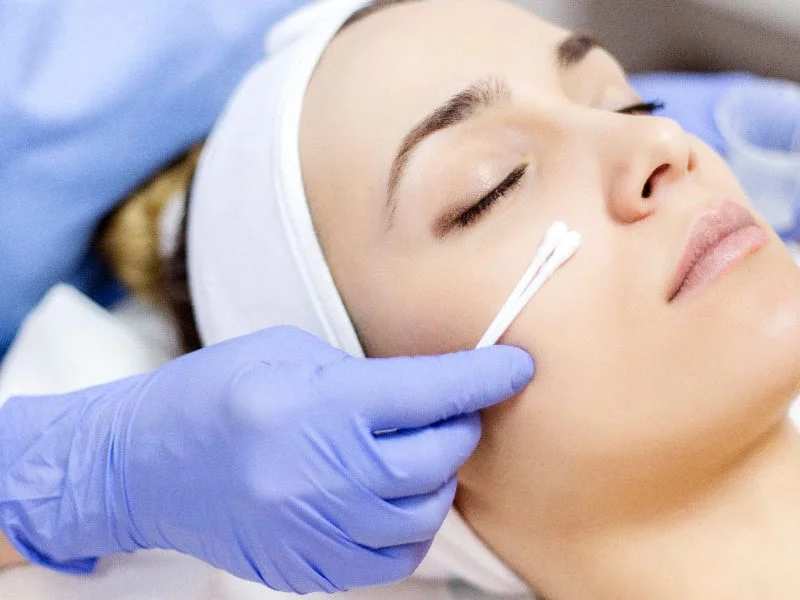 Manchas en la cara y melasma Puebla