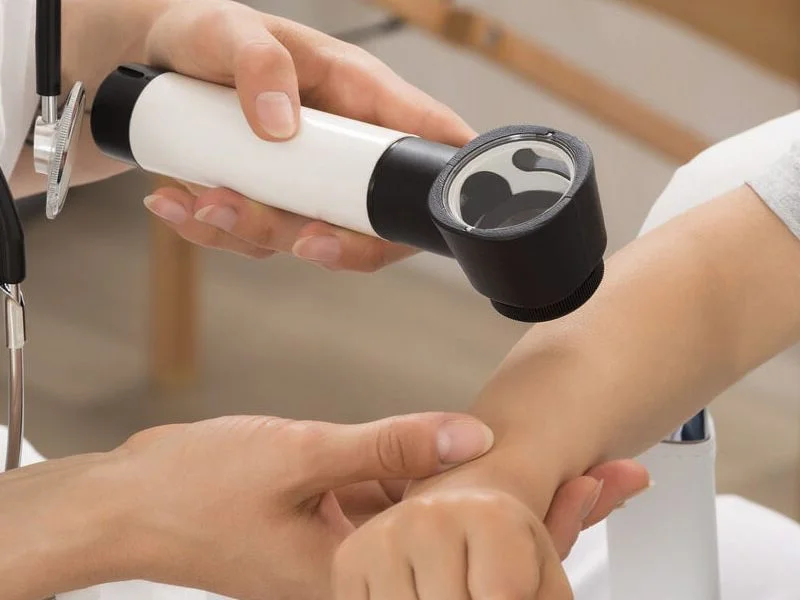 Revisión de lunares y tumores de piel Puebla